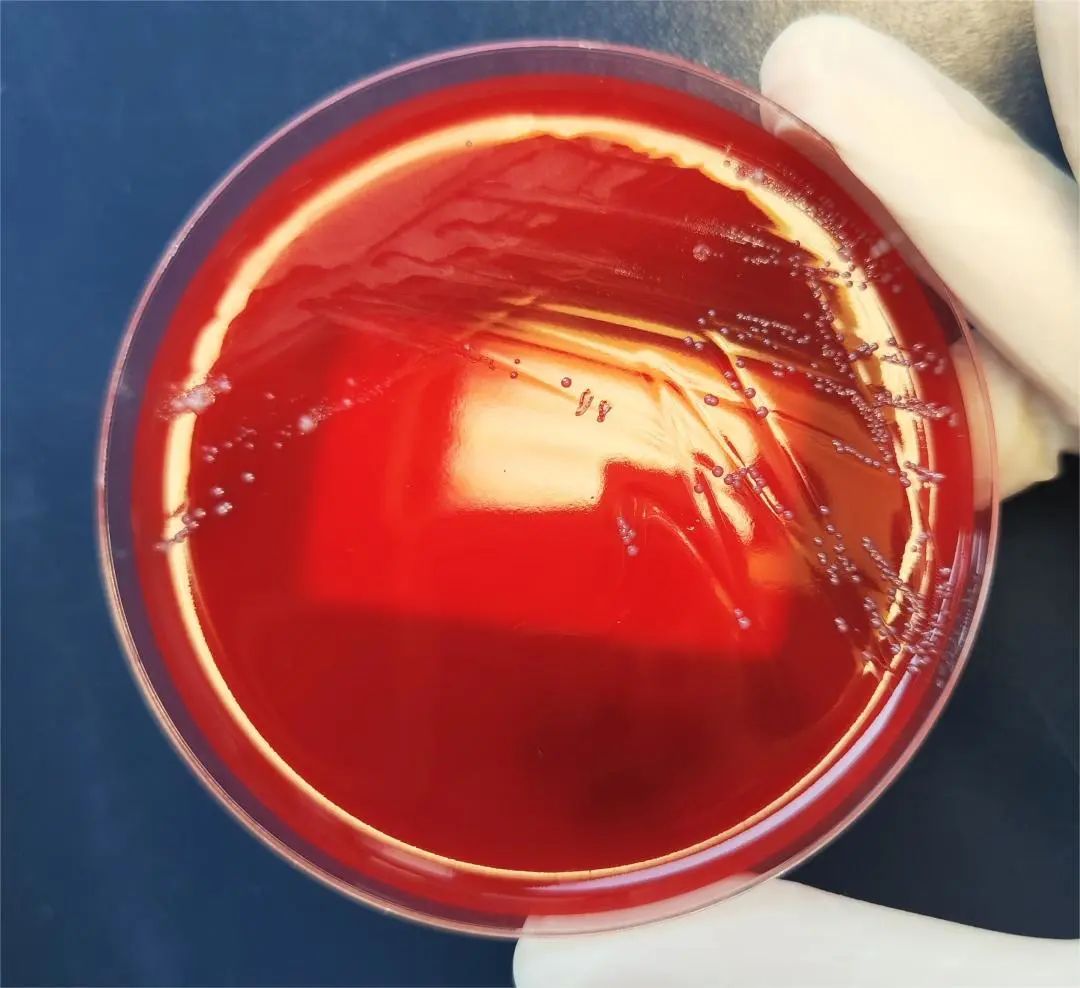 用药后再送尿培养会怎样？